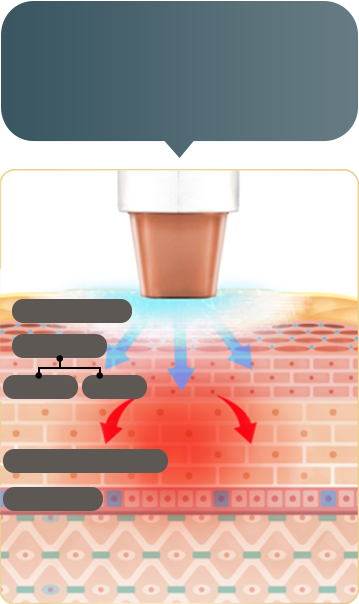 Jeisys(ジェイシス)DENSITY 高周波エネルギーのイメージ