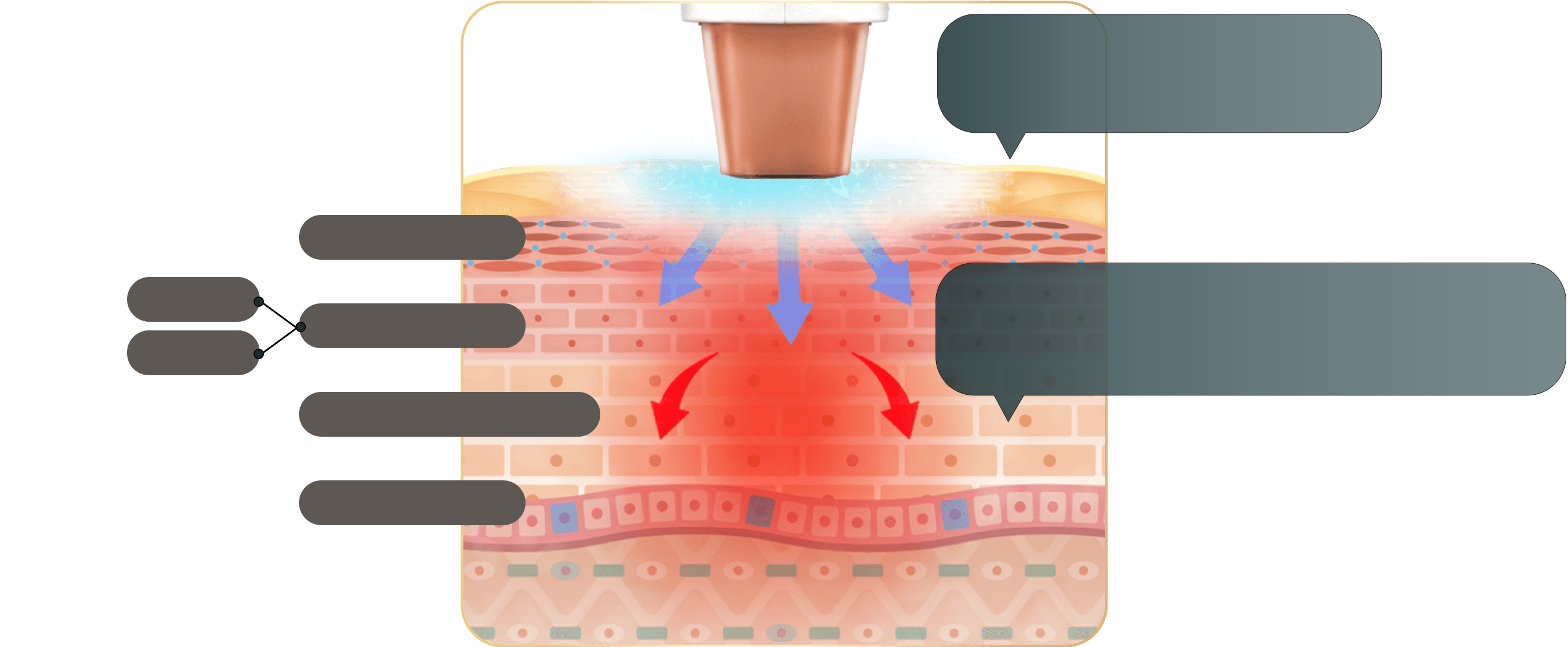 Jeisys(ジェイシス)DENSITY 高周波エネルギーのイメージ